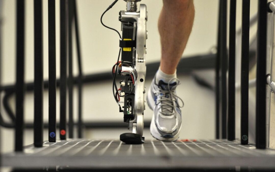 Révolution bionique : la prothèse de jambe commandée par le cerveau